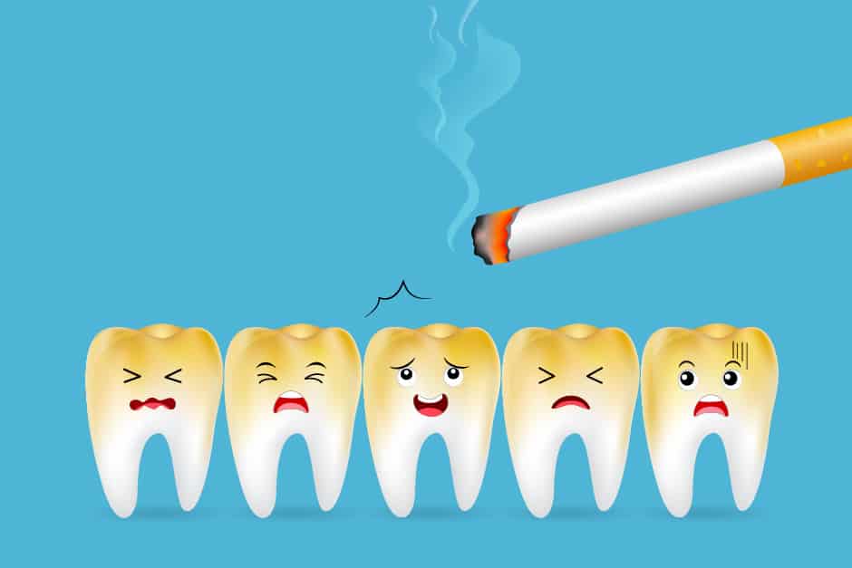 Will my Dentist Know That I Smoke? The effects of smoking on oral health