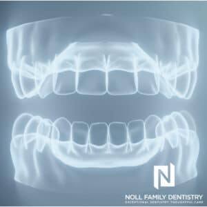 Dental x-rays